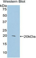 CENPE Antibody - Western blot of recombinant CENPE.  This image was taken for the unconjugated form of this product. Other forms have not been tested.