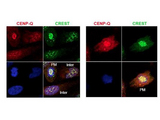 CENPQ Antibody - Anti-CENP-Q Antibody - Immunofluorescence Microscopy. Immunofluorescence microscopy using protein A purified anti-CENP-Q antibody shows detection of endogenous CENP-Q in HeLa whole cell lysate. Primary antibody was used at 1:100 followed by secondary antibody diluted 1:150. Red punctate anti-CENP-Q signal colocalizes in overlay images with green punctate anti-CREST signals at the kinetochores (attached points of sister chromatids). Visible are colocalized CENP-Q and CREST signal at various stages of the cell cycle as indicated from interphase to the end of mitosis. Nuclei are counter stained with bisbenzimide. Personal Communication, Kyung S. Lee, CCR-NCI, Bethesda, MD.
