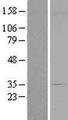 CENPV / p30 Protein - Western validation with an anti-DDK antibody * L: Control HEK293 lysate R: Over-expression lysate