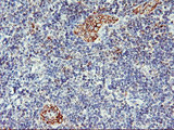 CENTG2 / AGAP1 Antibody - IHC of paraffin-embedded Human tonsil using anti-AGAP1 mouse monoclonal antibody.