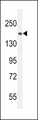 CEP164 Antibody - CE164 Antibody western blot of A549 cell line lysates (35 ug/lane). The CE164 antibody detected the CE164 protein (arrow).