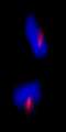 CEP170 Antibody - Detection of Human CEP170 by Immunocytochemistry. Sample: NBF-fixed asynchronous HeLa cells. Antibody: Affinity purified rabbit anti-CEP170 used at a dilution of 1:100. Detection: Red-fluorescent Alexa Fluor 594 goat anti-rabbit IgG (Invitrogen).
