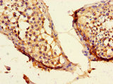 CEP192 Antibody - Immunohistochemistry of paraffin-embedded human testicular tissue using CEP192 Antibody at dilution of 1:100