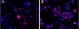 CEP290 Antibody - Goat Anti-CEP290  Antibody (2.5ug/ml overnight staining of cell lines OPCT-1 (A) and MDA468 (fB) with Alexa Fluor 568 (red) and nuclear counter staining with DAPI (blue). Data kindly provided by Dr S, McArdle, and obtained by Sumanjeet Malhi, John van Geest Research Centre, Nottingham, UK