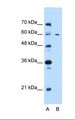 CEP55 Antibody - Lane A: Marker. Lane B: 721B cell lysate. Antibody concentration: 0.25 ug/ml. Gel concentration: 12%.  This image was taken for the unconjugated form of this product. Other forms have not been tested.