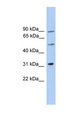CEP57L1 Antibody - CEP57L1 / C6orf182 antibody Western blot of Jurkat lysate. This image was taken for the unconjugated form of this product. Other forms have not been tested.