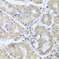 CEP57L1 Antibody - Immunohistochemistry of paraffin-embedded human stomach tissue.