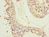 CEP72 Antibody - Immunohistochemistry of paraffin-embedded human testis tissue at dilution of 1:100