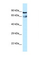 CEP76 Antibody - CEP76 antibody Western blot of Fetal Lung lysate. Antibody concentration 1 ug/ml.  This image was taken for the unconjugated form of this product. Other forms have not been tested.