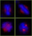 CEP78 / IP63 Antibody - Detection of Human CEP78 by Immunocytochemistry. Sample: NBF-fixed asynchronous HeLa cells. Antibody: Affinity purified rabbit anti-CEP78 used at a dilution of 1:250. Detection: Red-fluorescent goat anti-rabbit IgG highly cross-adsorbed Antibody Hilyte Plus 555 (A120-501E) used at a dilution of 1:100.