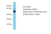 CEP83 / CCDC41 Antibody -  This image was taken for the unconjugated form of this product. Other forms have not been tested.