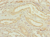 CEP83 / CCDC41 Antibody - Immunohistochemistry of paraffin-embedded human kidney tissue at dilution of 1:100