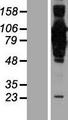 CEP85 / CCDC21 Protein - Western validation with an anti-DDK antibody * L: Control HEK293 lysate R: Over-expression lysate