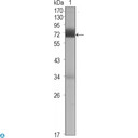 CER1 Antibody - Immunohistochemistry (IHC) analysis of paraffin-embedded human gastric cancer (left) and normal gastric tissues (right) with DAB staining using Cerberus Monoclonal Antibody.