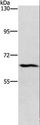 CERKL Antibody - Western blot analysis of HeLa cell, using CERKL Polyclonal Antibody at dilution of 1:1100.