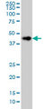 CerS6 / LASS6 Antibody - LASS6 monoclonal antibody (M01), clone 5H7 Western blot of LASS6 expression in HeLa.