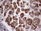 CETN1 Antibody - IHC of paraffin-embedded Carcinoma of Human pancreas tissue using anti-CETN1 mouse monoclonal antibody. (Heat-induced epitope retrieval by 1 mM EDTA in 10mM Tris, pH8.5, 120°C for 3min).
