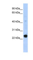 CFAP20 / GTL3 Antibody - C16orf80 / GTL3 antibody Western blot of HepG2 cell lysate. This image was taken for the unconjugated form of this product. Other forms have not been tested.