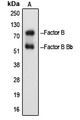 CFB / Complement Factor B Antibody - Western blot analysis of Factor B Bb expression in Raji Etoposide-treated (A) whole cell lysates.