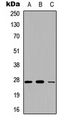 CFD / Factor D / Adipsin Antibody - Western blot analysis of Adipsin expression in A549 (A); NS-1 (B); PC12 (C) whole cell lysates.