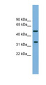CFDP1 Antibody - CFDP1 antibody Western blot of NCI-H226 cell lysate. This image was taken for the unconjugated form of this product. Other forms have not been tested.