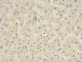 CFHR2 Antibody - Immunohistochemistry of paraffin-embedded human liver tissue using antibody at 1:100 dilution.