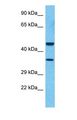 CFHR3 / CFHL3 Antibody - Western blot of FHR3 Antibody with human MCF7 Whole Cell lysate.  This image was taken for the unconjugated form of this product. Other forms have not been tested.