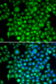 CFI / Complement Factor I Antibody - Immunofluorescence analysis of HeLa cells.