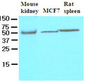 CFLAR / FLIP Antibody - Cell lysates of mouse kidney, MCF7 and rat spleen (40 ug) were resolved by SDS-PAGE, transferred to NC membrane and probed with anti-human FLIP (1:500). Proteins were visualized using a goat anti-mouse secondary antibody conjugated to HRP and an ECL detection system.