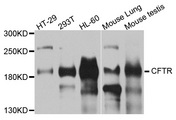 CFTR Antibody - Western blot analysis of extracts of various cells.