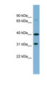 CG6 / C9orf4 Antibody - C9orf4 antibody Western blot of ACHN lysate. This image was taken for the unconjugated form of this product. Other forms have not been tested.
