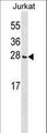 CGGBP1 Antibody - CGGBP1 Antibody western blot of Jurkat cell line lysates (35 ug/lane). The CGGBP1 Antibody detected the CGGBP1 protein (arrow).