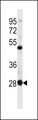 CGI-96 / RRP7A Antibody - RRP7A Antibody western blot of CEM cell line lysates (35 ug/lane). The RRP7A antibody detected the RRP7A protein (arrow).
