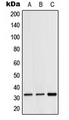 CGREF1 Antibody - Western blot analysis of Hydrophobestin expression in HeLa (A); SP2/0 (B); H9C2 (C) whole cell lysates.