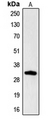 CGREF1 Antibody - Western blot analysis of Hydrophobestin expression in HL60 (A) whole cell lysates.