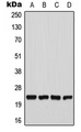 CHAC1 / MGC4504 Antibody - Western blot analysis of CHAC1 expression in U2OS (A); HeLa (B); Raw264.7 (C); PC12 (D) whole cell lysates.