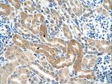 CHAF1B / CAF1 Antibody - CHAF1B antibody CHAF1B(chromatin assembly factor 1, subunit B (p60)) Antibody was used in IHC to stain formalin-fixed, paraffin-embedded human kidney.  This image was taken for the unconjugated form of this product. Other forms have not been tested.