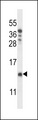 CHCHD8 Antibody - CHCH8 Antibody western blot of T47D cell line lysates (35 ug/lane). The CHCH8 antibody detected the CHCH8 protein (arrow).