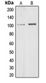 CHD1L Antibody - Western blot analysis of CHD1L expression in HeLa (A); HEK293T (B) whole cell lysates.