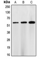 CHEK1 / CHK1 Antibody - Western blot analysis of CHK1 expression in HEK293T (A); NIH3T3 (B); rat heart (C) whole cell lysates.
