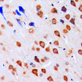 CHEK1 / CHK1 Antibody - Immunohistochemical analysis of CHK1 staining in human brain formalin fixed paraffin embedded tissue section. The section was pre-treated using heat mediated antigen retrieval with sodium citrate buffer (pH 6.0). The section was then incubated with the antibody at room temperature and detected using an HRP conjugated compact polymer system. DAB was used as the chromogen. The section was then counterstained with hematoxylin and mounted with DPX.