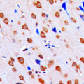 CHEK1 / CHK1 Antibody - Immunohistochemical analysis of CHK1 (pS317) staining in human brain formalin fixed paraffin embedded tissue section. The section was pre-treated using heat mediated antigen retrieval with sodium citrate buffer (pH 6.0). The section was then incubated with the antibody at room temperature and detected using an HRP conjugated compact polymer system. DAB was used as the chromogen. The section was then counterstained with hematoxylin and mounted with DPX.