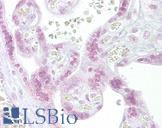 CHEK2 / CHK2 Antibody - Anti-CHEK2 / CHK2 antibody IHC of human placenta. Immunohistochemistry of formalin-fixed, paraffin-embedded tissue after heat-induced antigen retrieval. Antibody concentration 10 ug/ml.  This image was taken for the unconjugated form of this product. Other forms have not been tested.