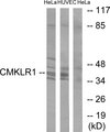 CHEMR23 / CMKLR1 Antibody - Western blot analysis of lysates from HeLa and HUVEC cells, using CMKLR1 Antibody. The lane on the right is blocked with the synthesized peptide.