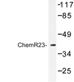 CHEMR23 / CMKLR1 Antibody - Western blot of ChemR23 (R249) pAb in extracts from Jurkat cells.