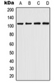 CHERP Antibody - Western blot analysis of CHERP expression in THP1 (A); K562 (B); Raw264.7 (C); H9C2 (D) whole cell lysates.