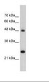 CHGA / Chromogranin A Antibody - HepG2 Cell Lysate.  This image was taken for the unconjugated form of this product. Other forms have not been tested.