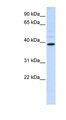 CHIA / Amcase Antibody - CHIA / Amcase antibody Western blot of HeLa lysate. This image was taken for the unconjugated form of this product. Other forms have not been tested.