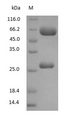 Chicken IgY Protein - (Tris-Glycine gel) Discontinuous SDS-PAGE (reduced) with 5% enrichment gel and 15% separation gel.