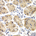 CHIT1 / Chitotriosidase Antibody - Immunohistochemistry of paraffin-embedded human normal stomach using CHIT1 antibody at dilution of 1:200 (400x lens).